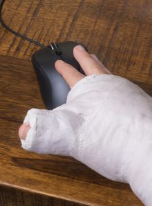 Hand with huge cast trying to use a mouse