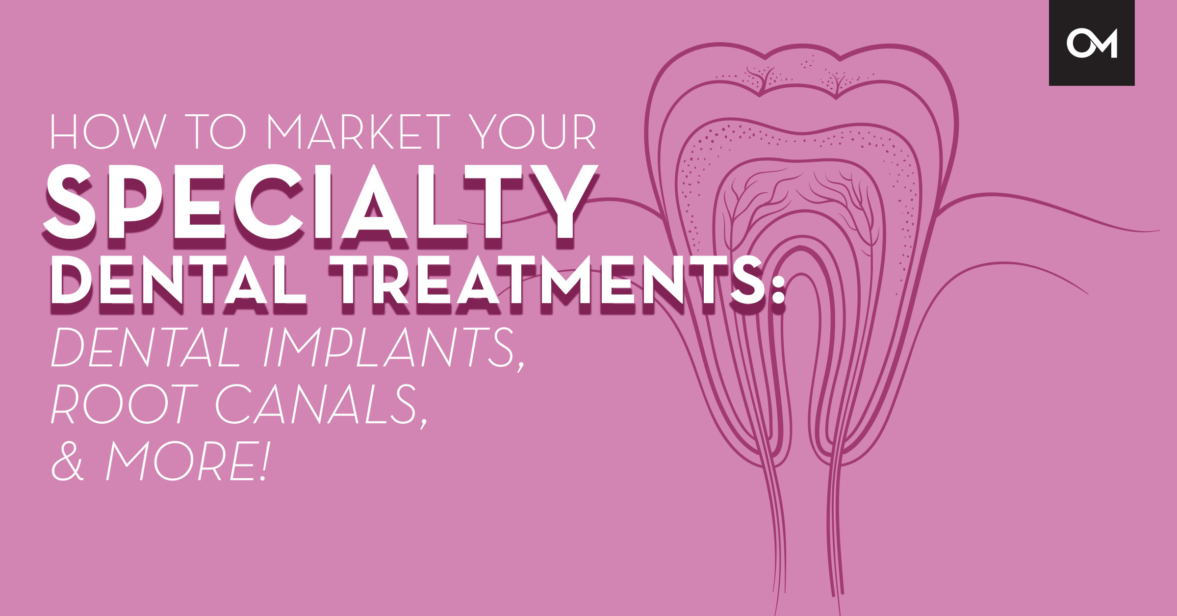 How to market your specialty dental treatments